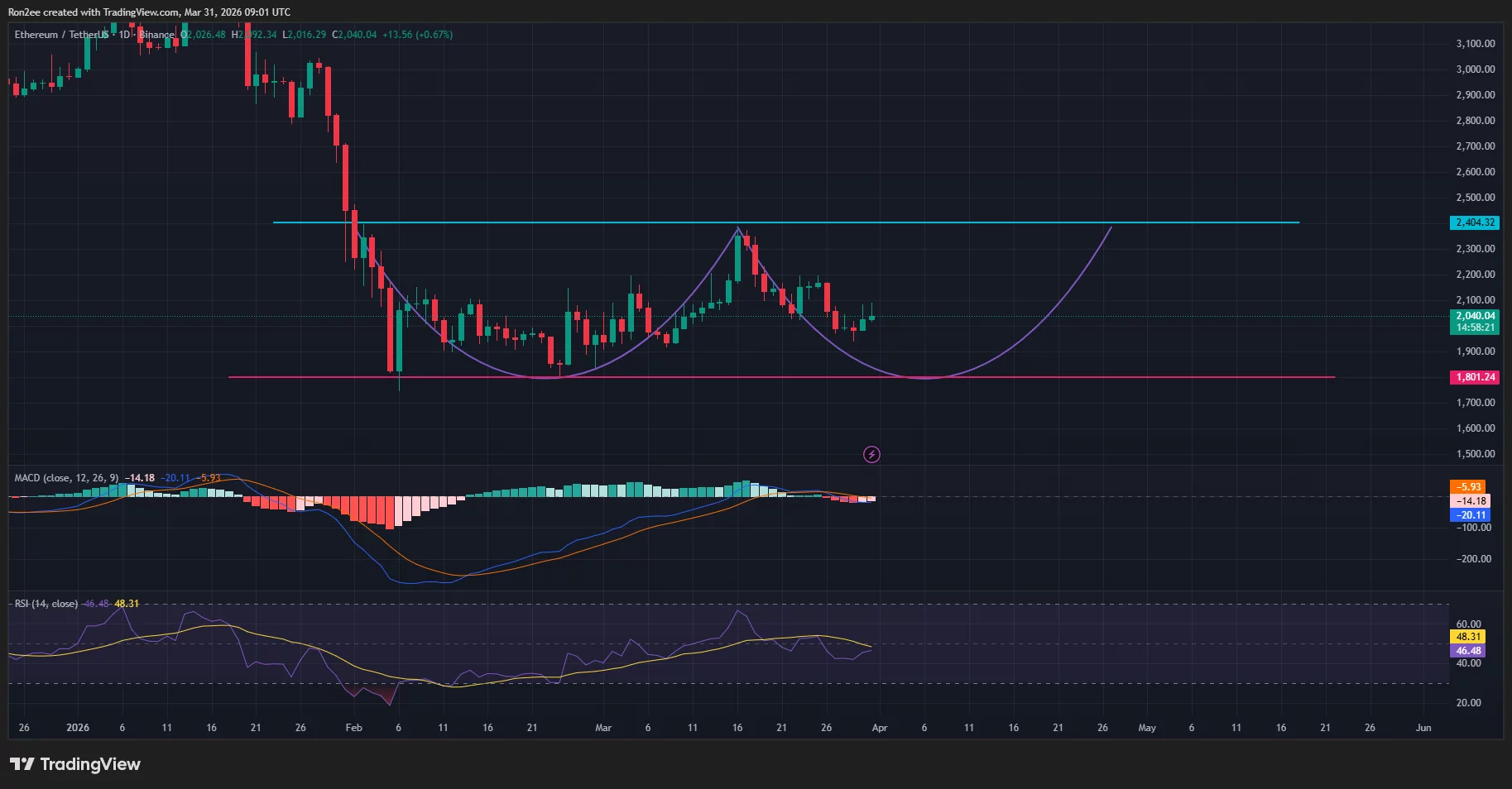 Ethereum price appears to be forming a double bottom pattern on the daily chart.